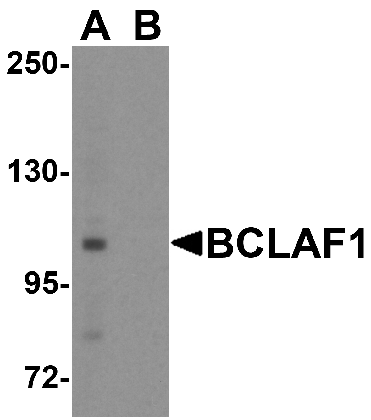 Western blot analysis of BCLAF1 in human brain tissue lysate with BCLAF1 antibody at 1 μg/ml. Western blot analysis of BCLAF1 in human brain tissue lysate with BCLAF1 antibody at 1 μg/ml.