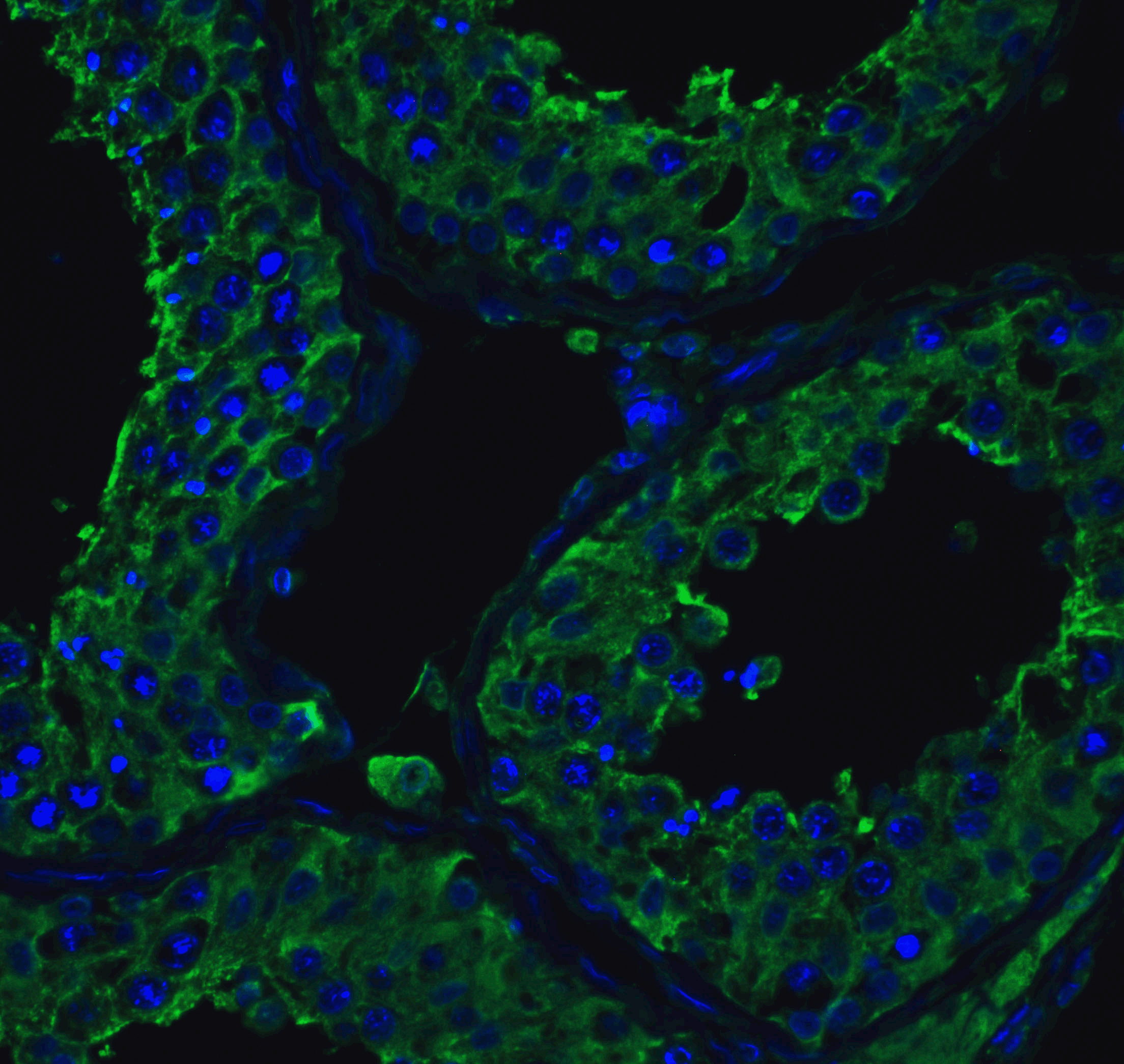 <strong>Figure 5 Immunofluorescence Validation of ACE2 in Human Testis Tissue</strong><br>
Immunofluorescent analysis of 4% paraformaldehyde-fixed human testis tissue labeling ACE-2 with 3217 at 20 μg/mL, followed by goat anti-rabbit IgG secondary antibody at 1/500 dilution (green) and DAPI staining (blue). <strong>Figure 5 Immunofluorescence Validation of ACE2 in Human Testis Tissue</strong><br>
Immunofluorescent analysis of 4% paraformaldehyde-fixed human testis tissue labeling ACE-2 with 3217 at 20 μg/mL, followed by goat anti-rabbit IgG secondary antibody at 1/500 dilution (green) and DAPI staining (blue).