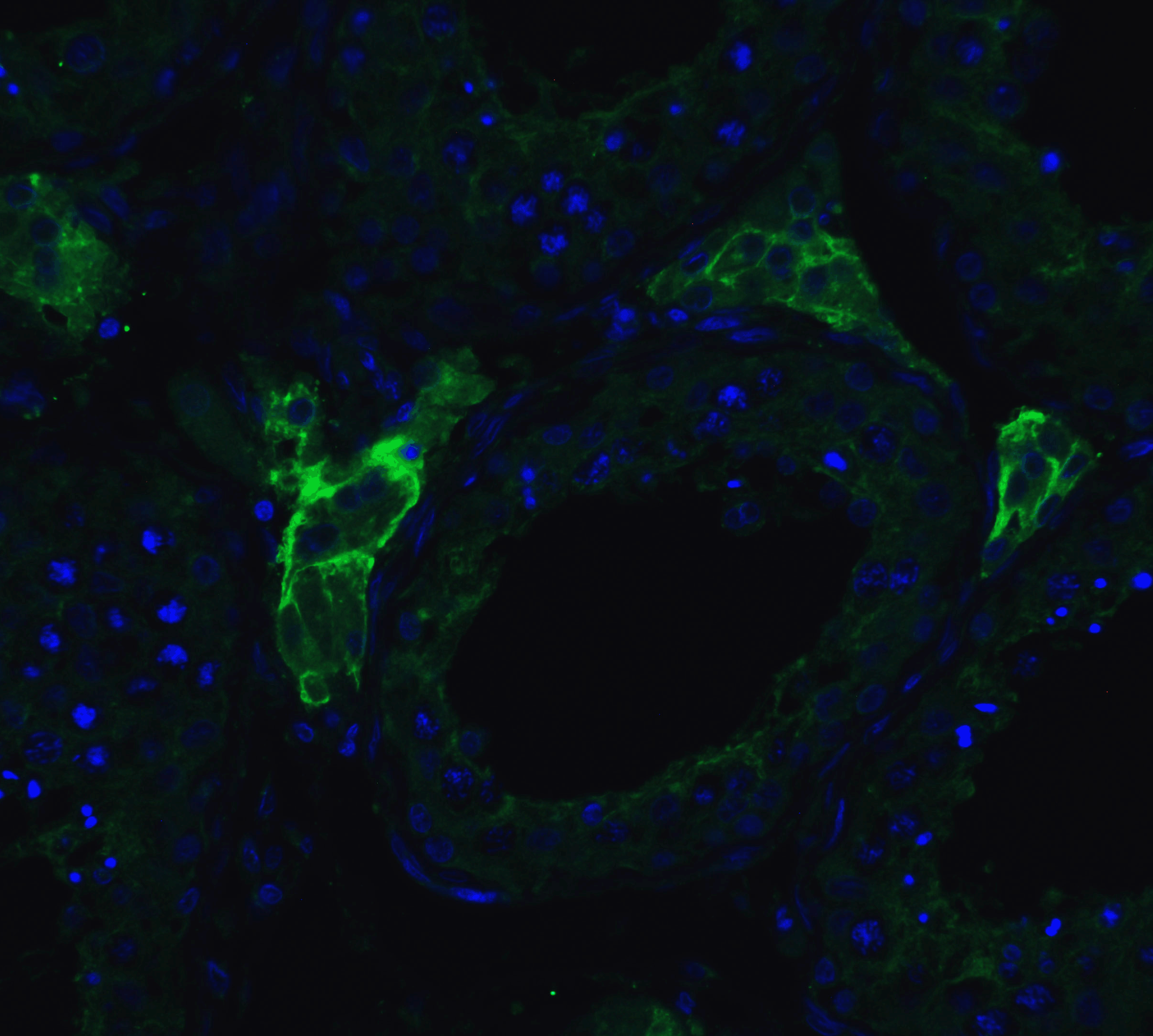 <strong>Figure 6 Immunofluorescence Validation of ACE2 in Human Testis Tissue</strong><br>
Immunofluorescent analysis of 4% paraformaldehyde-fixed human testis tissue labeling ACE-2 with 3227 at 20 μg/mL, followed by goat anti-rabbit IgG secondary antibody at 1/500 dilution (green) and DAPI staining (blue).