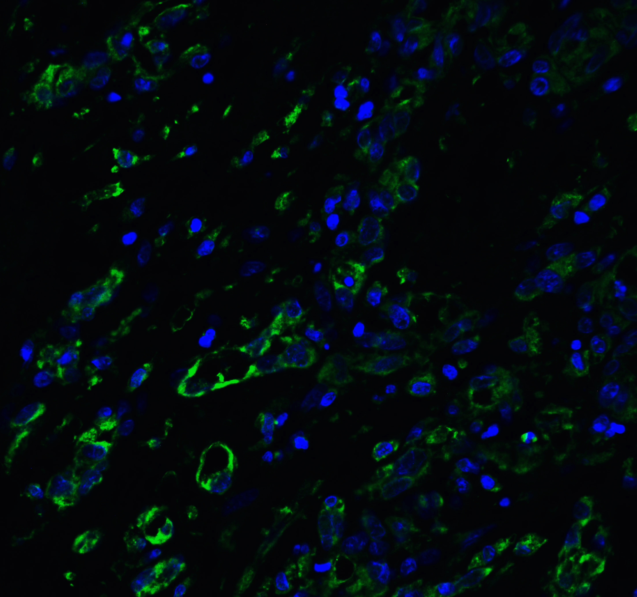 <strong>Figure 6 Immunofluorescence Validation of ACE2 in Human Lung Tissue</strong><br>
Immunofluorescent analysis of 4% paraformaldehyde-fixed human lung tissue labeling ACE-2 with 3217 at 20 μg/mL, followed by goat anti-rabbit IgG secondary antibody at 1/500 dilution (green) and DAPI staining (blue). <strong>Figure 6 Immunofluorescence Validation of ACE2 in Human Lung Tissue</strong><br>
Immunofluorescent analysis of 4% paraformaldehyde-fixed human lung tissue labeling ACE-2 with 3217 at 20 μg/mL, followed by goat anti-rabbit IgG secondary antibody at 1/500 dilution (green) and DAPI staining (blue).