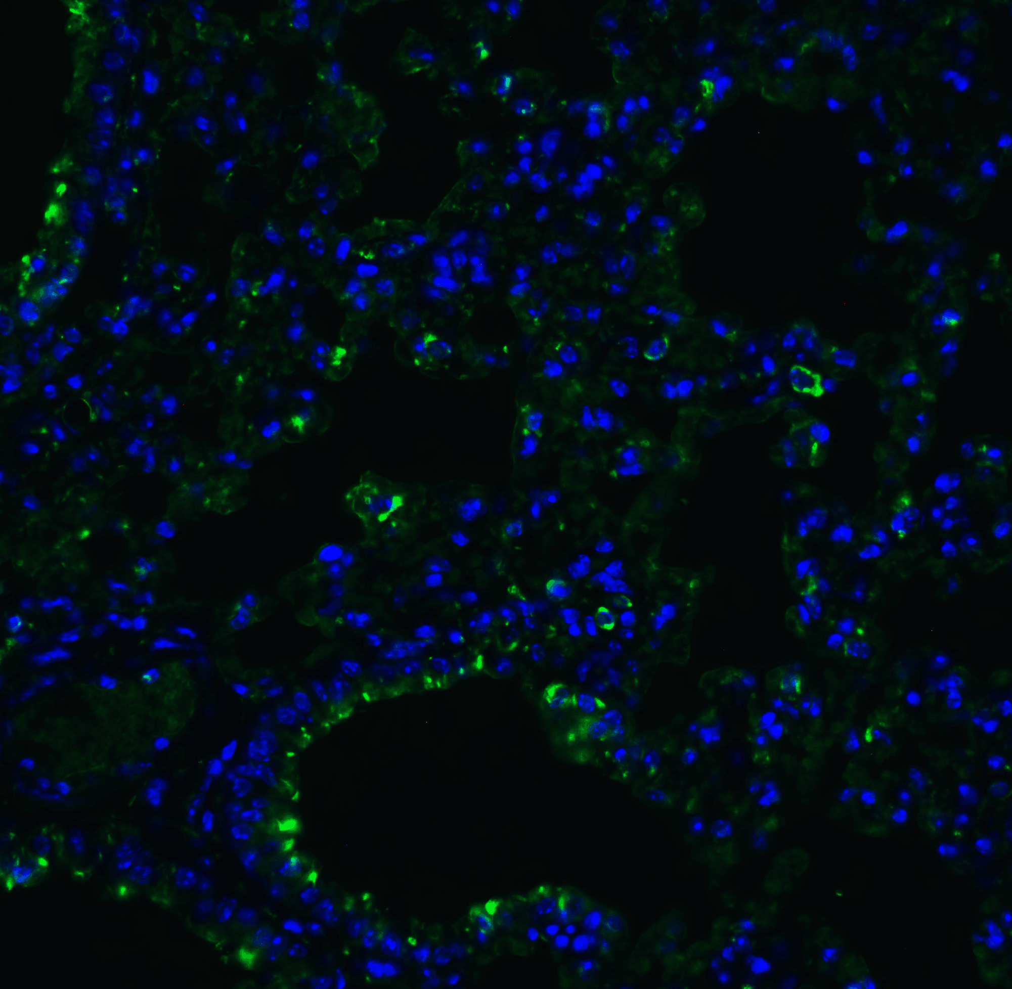 <strong>Figure 7 Immunofluorescence Validation of ACE2 in Mouse Lung Tissue</strong><br>
Immunofluorescent analysis of 4% paraformaldehyde-fixed mouse lung tissue labeling ACE-2 with 3217 at 20 μg/mL, followed by goat anti-rabbit IgG secondary antibody at 1/500 dilution (green) and DAPI staining (blue). <strong>Figure 7 Immunofluorescence Validation of ACE2 in Mouse Lung Tissue</strong><br>
Immunofluorescent analysis of 4% paraformaldehyde-fixed mouse lung tissue labeling ACE-2 with 3217 at 20 μg/mL, followed by goat anti-rabbit IgG secondary antibody at 1/500 dilution (green) and DAPI staining (blue).