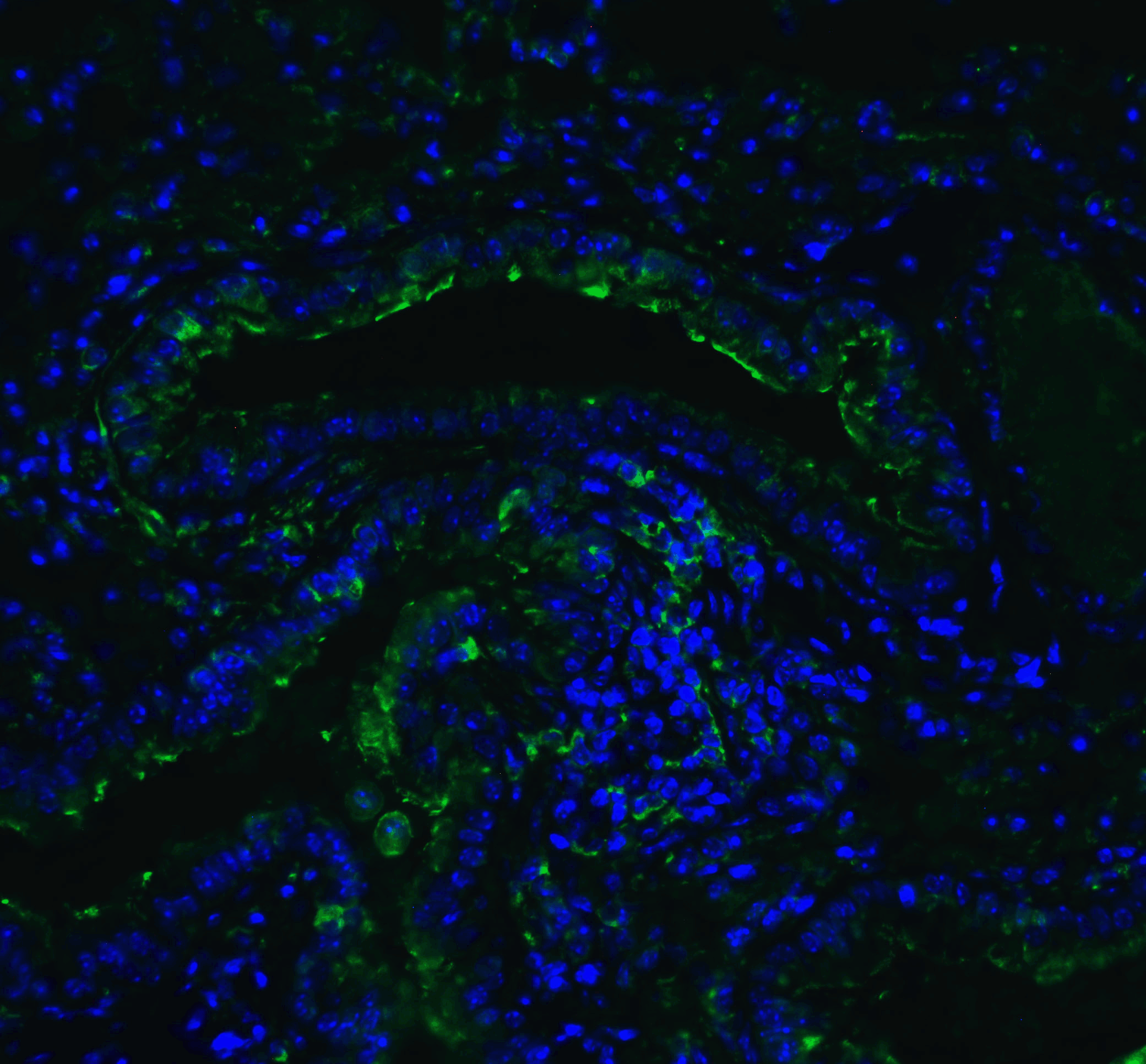 <strong>Figure 8 Immunofluorescence Validation of ACE2 in Mouse Lung Tissue</strong><br>
Immunofluorescent analysis of 4% paraformaldehyde-fixed mouse lung tissue labeling ACE-2 with 3227 at 20 μg/mL, followed by goat anti-rabbit IgG secondary antibody at 1/500 dilution (green) and DAPI staining (blue).