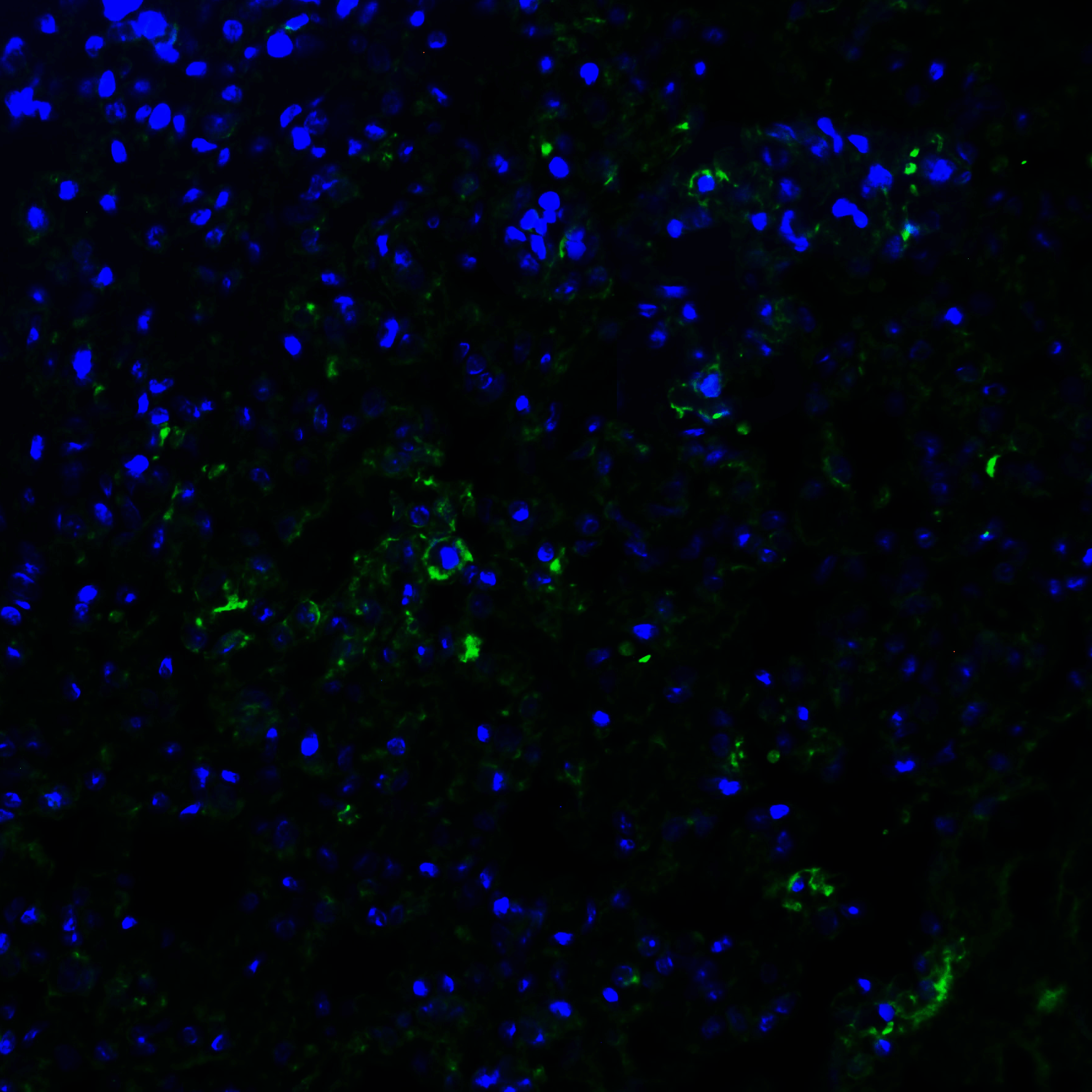 <strong>Figure 8 Immunofluorescence Validation of ACE2 in Rat Lung Tissue</strong><br>
Immunofluorescent analysis of 4% paraformaldehyde-fixed rat lung tissue labeling ACE-2 with 3217 at 20 μg/mL, followed by goat anti-rabbit IgG secondary antibody at 1/500 dilution (green) and DAPI staining (blue). <strong>Figure 8 Immunofluorescence Validation of ACE2 in Rat Lung Tissue</strong><br>
Immunofluorescent analysis of 4% paraformaldehyde-fixed rat lung tissue labeling ACE-2 with 3217 at 20 μg/mL, followed by goat anti-rabbit IgG secondary antibody at 1/500 dilution (green) and DAPI staining (blue).
