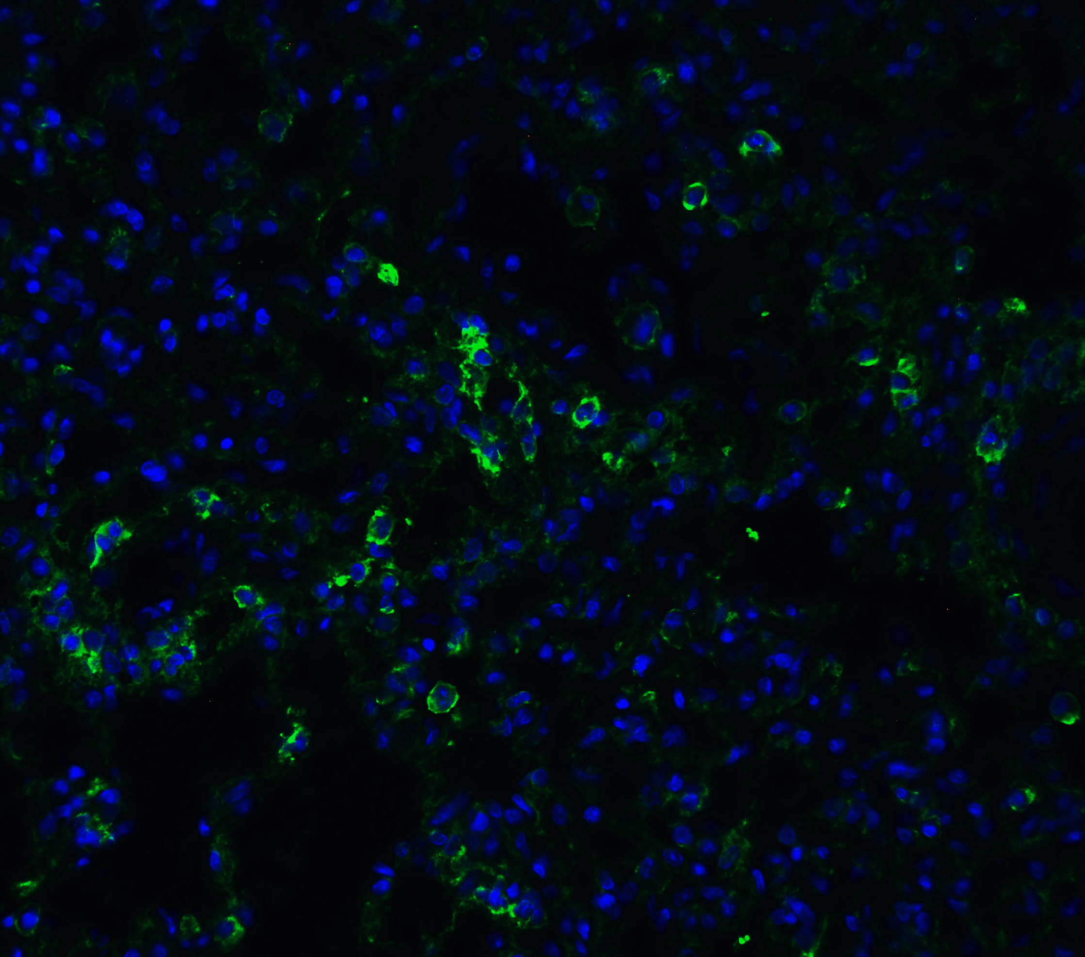 <strong>Figure 9 Immunofluorescence Validation of ACE2 in Rat Lung Tissue</strong><br>
Immunofluorescent analysis of 4% paraformaldehyde-fixed rat lung tissue labeling ACE-2 with 3227 at 20 μg/mL, followed by goat anti-rabbit IgG secondary antibody at 1/500 dilution (green) and DAPI staining (blue).
