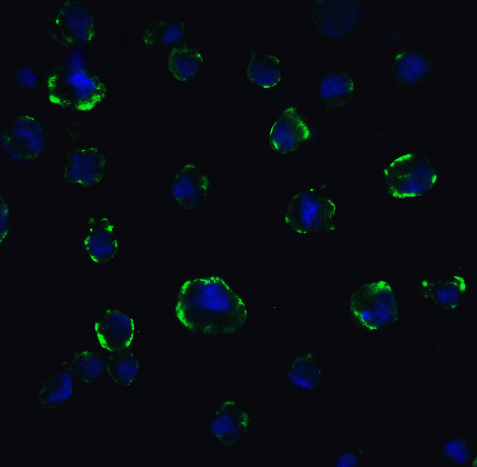 <strong>Figure 11 Immunofluorescence Validation of ACE2 In Caco2 Cells </strong><br>
Immunofluorescent analysis of 4% paraformaldehyde-fixed Caco2 cells labeling ACE2 with 3217 at 5 μg/mL, followed by goat anti-rabbit IgG secondary antibody at 1/500 dilution (green) and DAPI staining (blue). Image showing membrane staining on Caco2 cells. <strong>Figure 11 Immunofluorescence Validation of ACE2 In Caco2 Cells </strong><br>
Immunofluorescent analysis of 4% paraformaldehyde-fixed Caco2 cells labeling ACE2 with 3217 at 5 μg/mL, followed by goat anti-rabbit IgG secondary antibody at 1/500 dilution (green) and DAPI staining (blue). Image showing membrane staining on Caco2 cells.