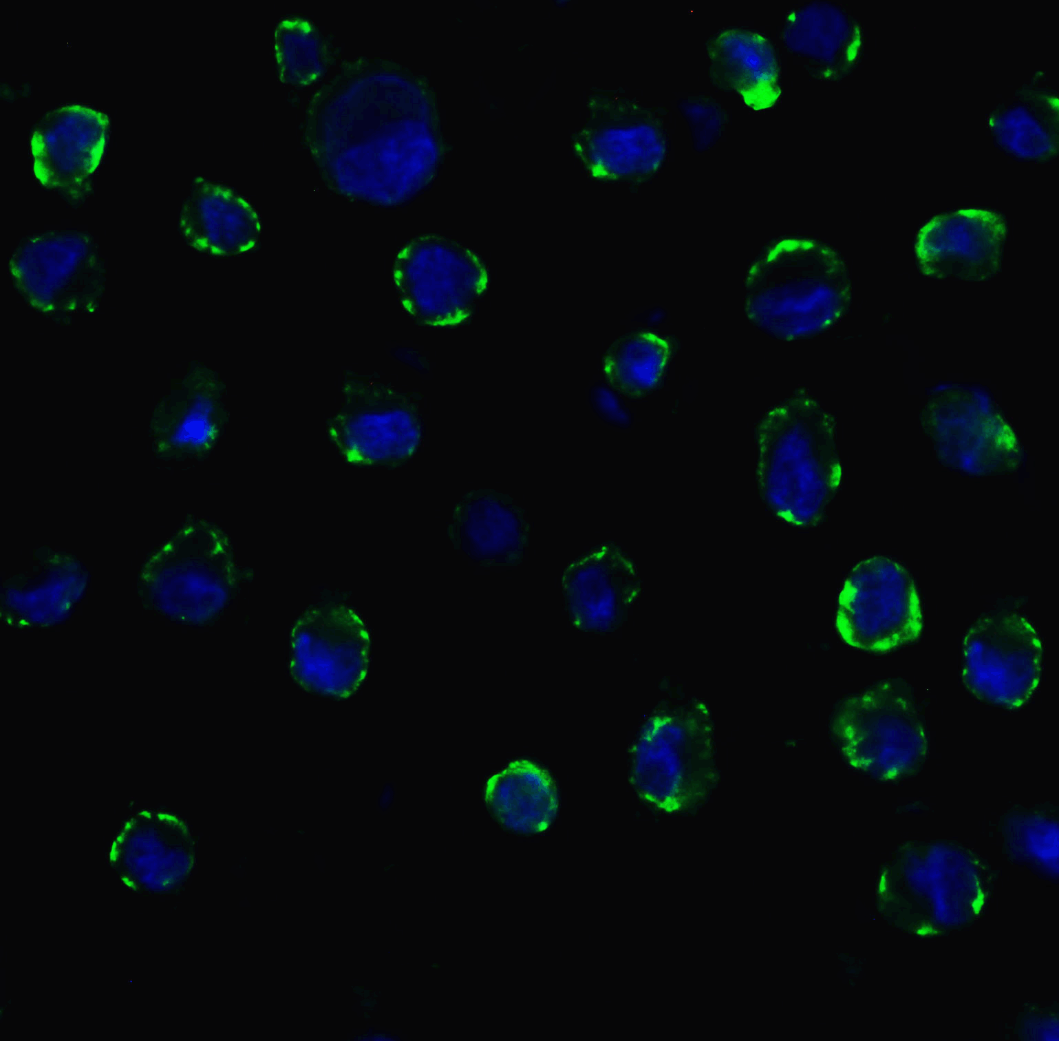 <strong>Figure 11 Immunofluorescence Validation of ACE2 In Caco2 Cells </strong><br> 
Immunofluorescent analysis of 4% paraformaldehyde-fixed Caco2 cells labeling ACE2 with 3227 at 20 μg/mL, followed by goat anti-rabbit IgG secondary antibody at 1/500 dilution (green) and DAPI staining (blue).  Image showing membrane staining on Caco2 cells.