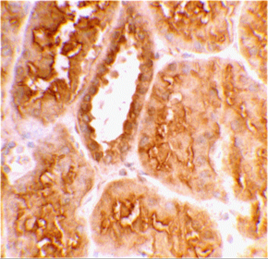<strong>Figure 9 Immunohistochemistry Validation of ACE2 in Human Kidney Tissue </strong><br>
Immunohistochemical analysis of paraffin-embedded human kidney tissue using anti-ACE2 antibody (3217) at 2 μg/ml. Tissue was fixed with formaldehyde and blocked with 10% serum for 1 h at RT; antigen retrieval was by heat mediation with a citrate buffer (pH6). Samples were incubated with primary antibody overnight at 4˚C. A goat anti-rabbit IgG H&L (HRP) at 1/250 was used as secondary. Counter stained with Hematoxylin. <strong>Figure 9 Immunohistochemistry Validation of ACE2 in Human Kidney Tissue </strong><br>
Immunohistochemical analysis of paraffin-embedded human kidney tissue using anti-ACE2 antibody (3217) at 2 μg/ml. Tissue was fixed with formaldehyde and blocked with 10% serum for 1 h at RT; antigen retrieval was by heat mediation with a citrate buffer (pH6). Samples were incubated with primary antibody overnight at 4˚C. A goat anti-rabbit IgG H&L (HRP) at 1/250 was used as secondary. Counter stained with Hematoxylin.