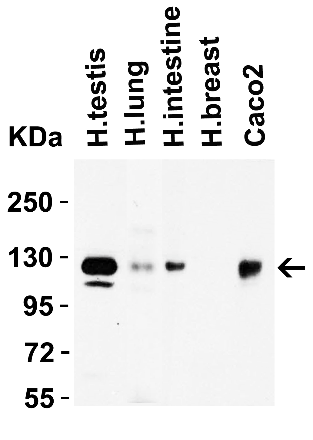<strong>Figure 2 Western Blot Validation in Human Tissues and Cell Line</strong><br>
Loading: 15 μg of lysates per lane.
Antibodies: ACE2, 3217 (2 μg/mL), 1h incubation at RT in 5% NFDM/TBST.
Secondary: Goat anti-rabbit IgG HRP conjugate at 1:10000 dilution. <strong>Figure 2 Western Blot Validation in Human Tissues and Cell Line</strong><br>
Loading: 15 μg of lysates per lane.
Antibodies: ACE2, 3217 (2 μg/mL), 1h incubation at RT in 5% NFDM/TBST.
Secondary: Goat anti-rabbit IgG HRP conjugate at 1:10000 dilution.