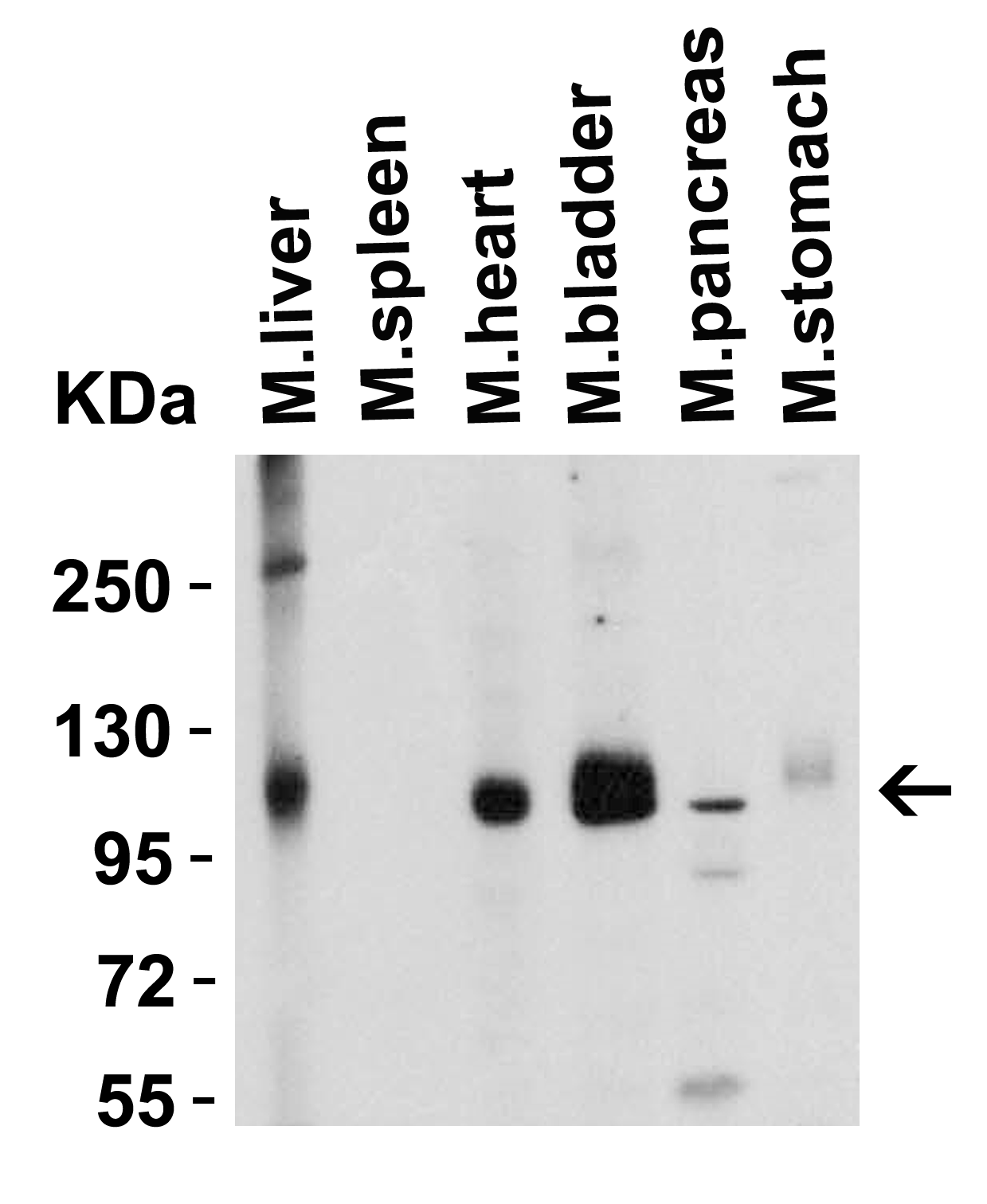 <strong>Figure 3 Western Blot Validation in Mouse Tissues </strong><br>
Loading: 15 μg of lysates per lane.
Antibodies: ACE2, 3217 (2 μg/mL), 1h incubation at RT in 5% NFDM/TBST.
Secondary: Goat anti-rabbit IgG HRP conjugate at 1:10000 dilution. <strong>Figure 3 Western Blot Validation in Mouse Tissues </strong><br>
Loading: 15 μg of lysates per lane.
Antibodies: ACE2, 3217 (2 μg/mL), 1h incubation at RT in 5% NFDM/TBST.
Secondary: Goat anti-rabbit IgG HRP conjugate at 1:10000 dilution.