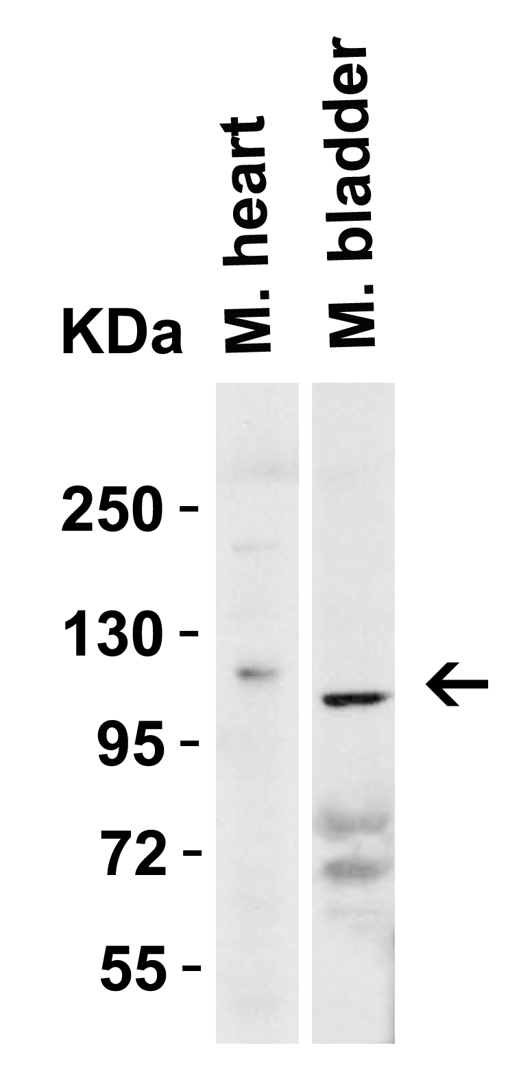 <strong>Figure 3 Western Blot Validation in Mouse Tissues</strong><br>
Loading: 15 μg of lysates per lane.
Antibodies: ACE2, 3227 (2 μg/mL),  1h incubation at RT  in 5% NFDM/TBST.
Secondary: Goat anti-rabbit IgG HRP conjugate at 1:10000 dilution.