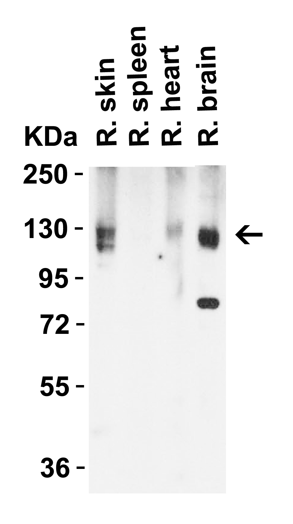 <strong>Figure 4 Western Blot Validation in Rat Tissues </strong><br>
Loading: 15 μg of lysates per lane.
Antibodies: ACE2, 3217 (2 μg/mL), 1h incubation at RT in 5% NFDM/TBST.
Secondary: Goat anti-rabbit IgG HRP conjugate at 1:10000 dilution. <strong>Figure 4 Western Blot Validation in Rat Tissues </strong><br>
Loading: 15 μg of lysates per lane.
Antibodies: ACE2, 3217 (2 μg/mL), 1h incubation at RT in 5% NFDM/TBST.
Secondary: Goat anti-rabbit IgG HRP conjugate at 1:10000 dilution.
