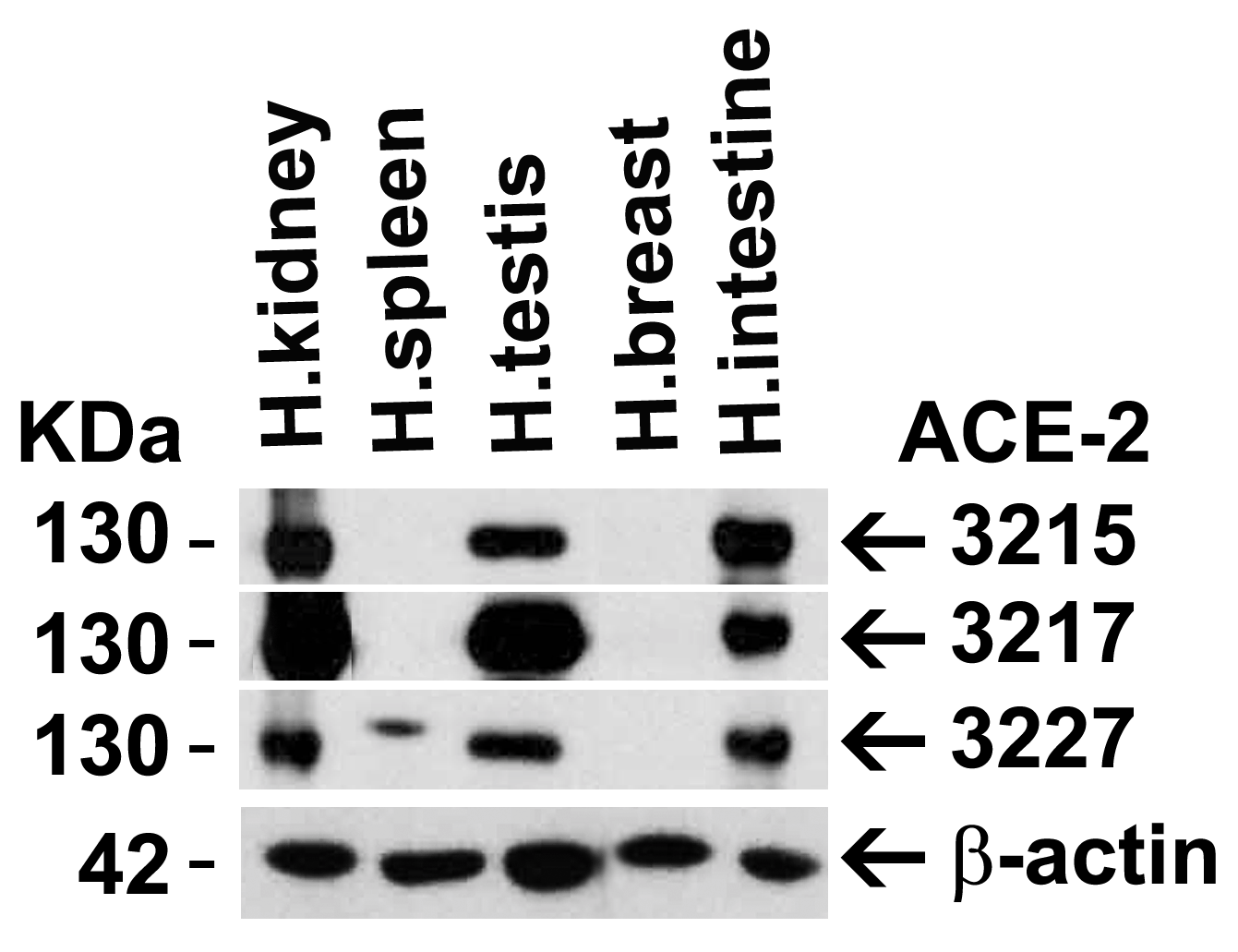 <strong>Figure 1 Independent Antibody Validation (IAV) via Protein Expression Profile in Human Tissues</strong><br>
Loading: 15 μg of lysates per lane.
Antibodies: ACE2, 3215 (2 μg/mL), ACE2, 3217 (2 μg/mL), ACE2, 3217 (2 μg/mL) and beta-actin 3779 (1 μg/mL), 1h incubation at RT in 5% NFDM/TBST.
Secondary: Goat anti-rabbit IgG HRP conjugate at 1:10000 dilution. <strong>Figure 1 Independent Antibody Validation (IAV) via Protein Expression Profile in Human Tissues</strong><br>
Loading: 15 μg of lysates per lane.
Antibodies: ACE2, 3215 (2 μg/mL), ACE2, 3217 (2 μg/mL), ACE2, 3217 (2 μg/mL) and beta-actin 3779 (1 μg/mL), 1h incubation at RT in 5% NFDM/TBST.
Secondary: Goat anti-rabbit IgG HRP conjugate at 1:10000 dilution.