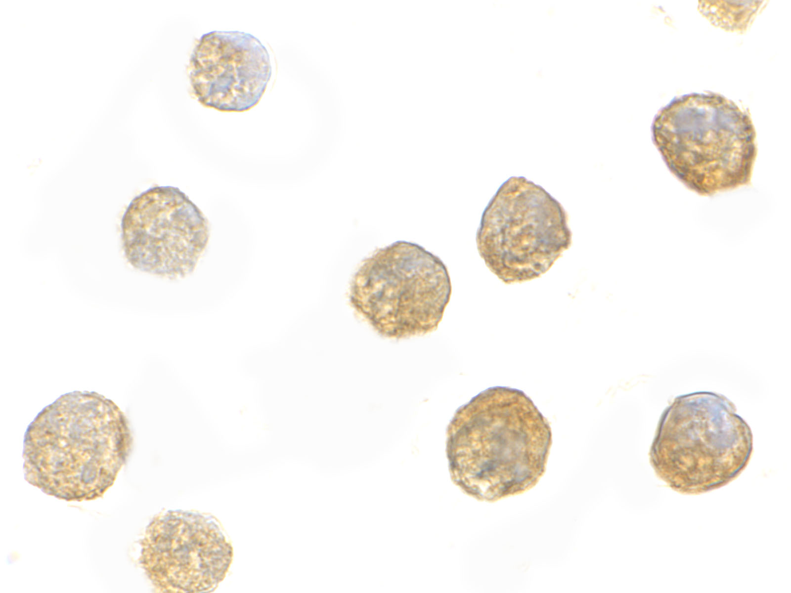 Immunocytochemistry of ADAP in K562 cells with ADAP antibody at 10 μg/mL. Immunocytochemistry of ADAP in K562 cells with ADAP antibody at 10 μg/mL.