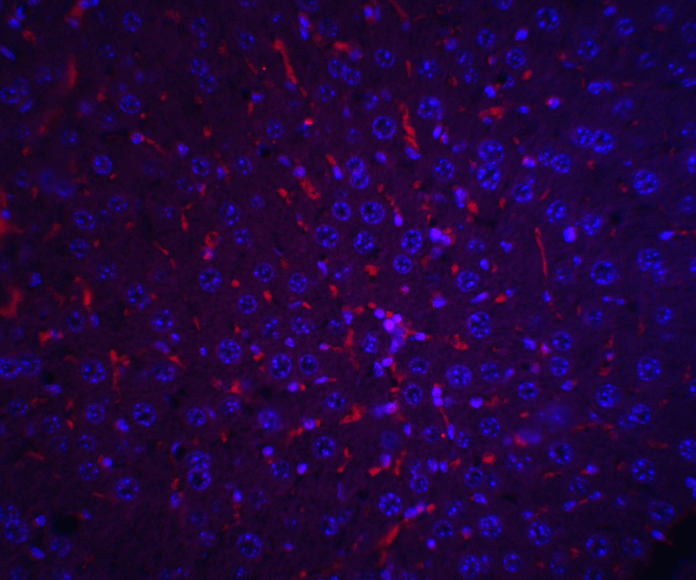 Immunofluorescence of AFP in mouse liver tissue with AFP antibody at 20 μg/mL.<br><br>Red: AFP Antibody (5869) <br> Blue: DAPI staining Immunofluorescence of AFP in mouse liver tissue with AFP antibody at 20 μg/mL.<br><br>Red: AFP Antibody (5869) <br> Blue: DAPI staining