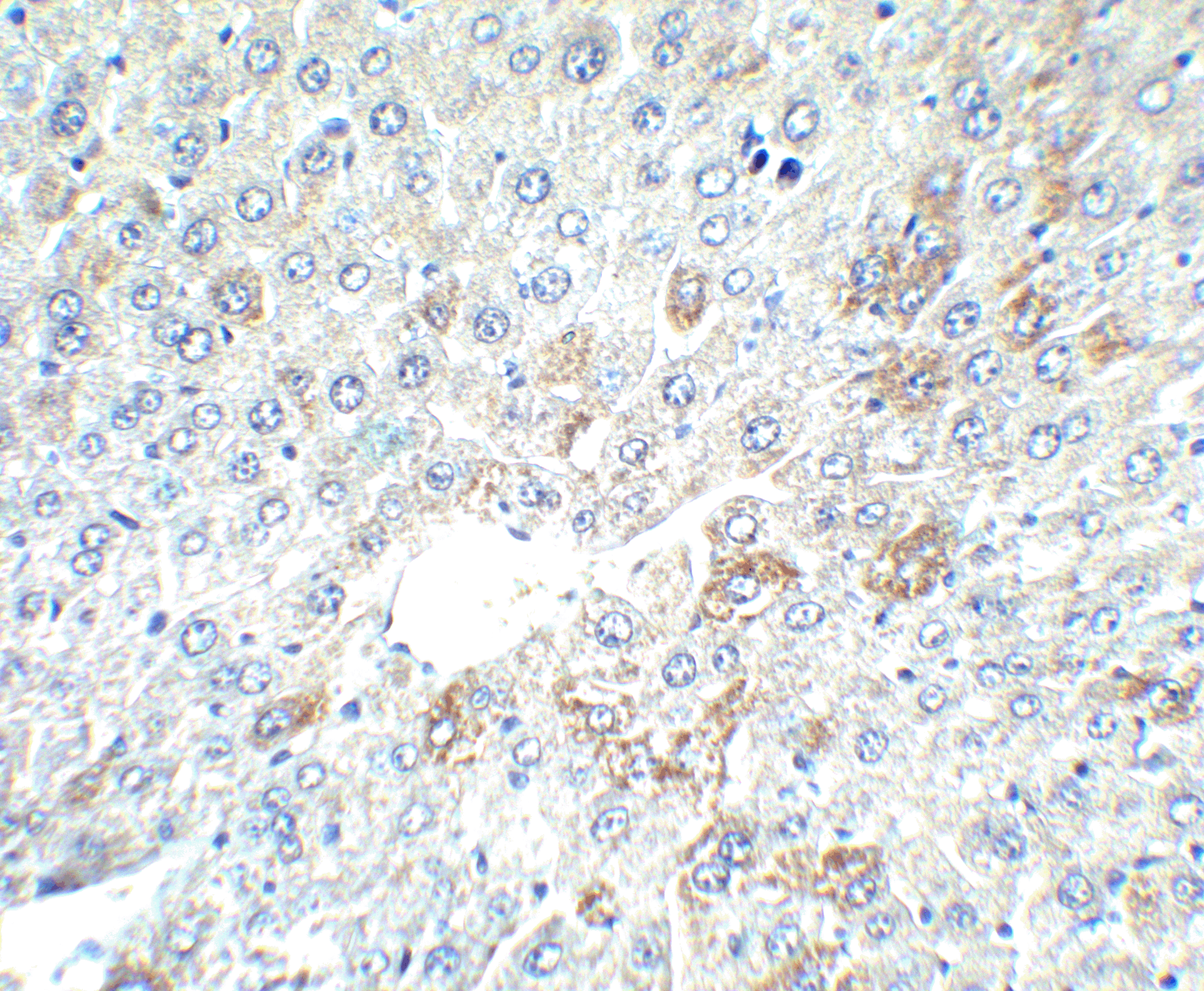 Immunohistochemistry of AFP in mouse liver tissue with AFP antibody at 2.5 μg/ml. Immunohistochemistry of AFP in mouse liver tissue with AFP antibody at 2.5 μg/ml.