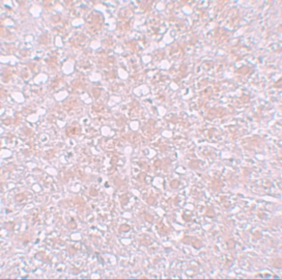 Immunohistochemistry of AFP in rat liver tissue with AFP antibody at 10 μg/mL. Immunohistochemistry of AFP in rat liver tissue with AFP antibody at 10 μg/mL.