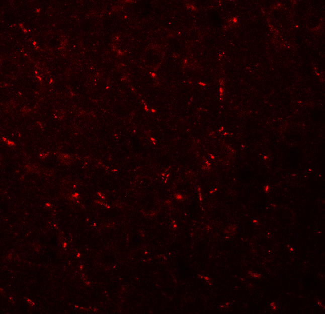 Immunofluorescence of AP3M1 in mouse brain tissue with AP3M1 antibody at 20 μg/mL. Immunofluorescence of AP3M1 in mouse brain tissue with AP3M1 antibody at 20 μg/mL.