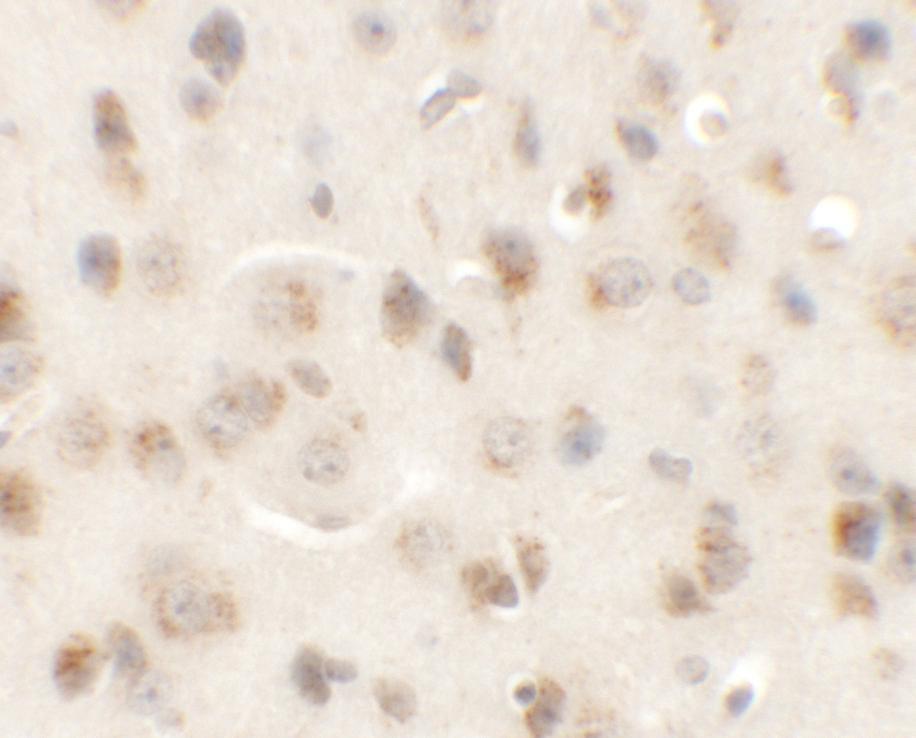 Immunohistochemistry of AP3M1 in mouse brain tissue with AP3M1 antibody at 5 μg/mL. Immunohistochemistry of AP3M1 in mouse brain tissue with AP3M1 antibody at 5 μg/mL.