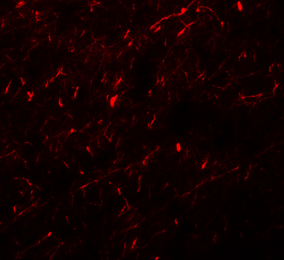 Immunofluorescence of APBA1 in human brain tissue with APBA1 antibody at 20 μg/mL. Immunofluorescence of APBA1 in human brain tissue with APBA1 antibody at 20 μg/mL.