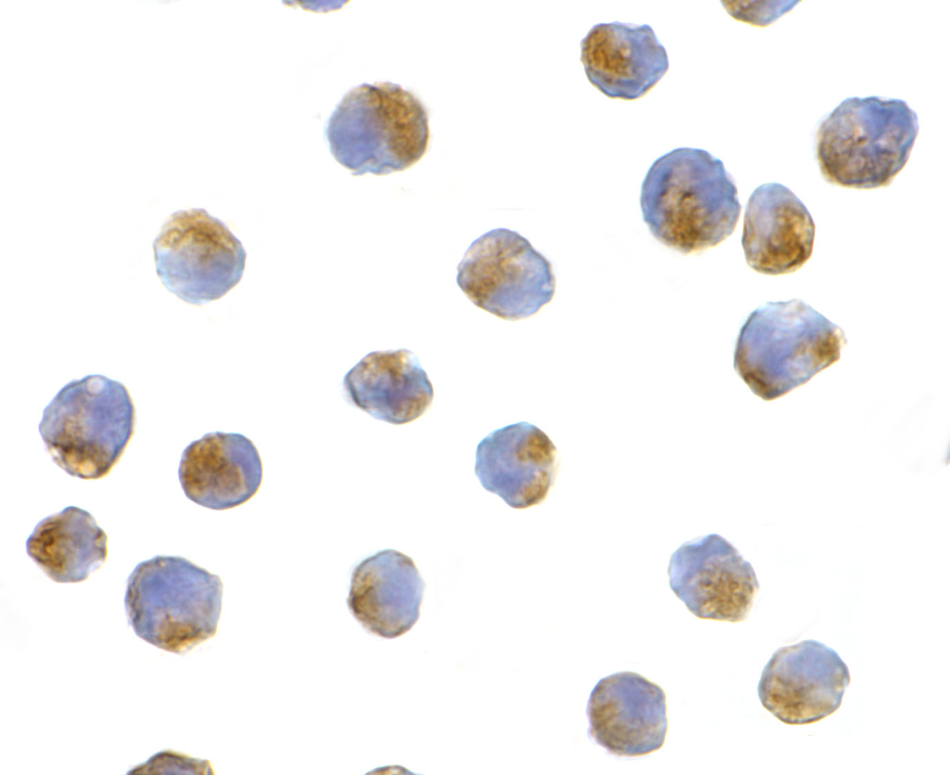 Immunocytochemistry of APG7 in L1210 cells with APG7 antibody at 10 μg/mL. Immunocytochemistry of APG7 in L1210 cells with APG7 antibody at 10 μg/mL.