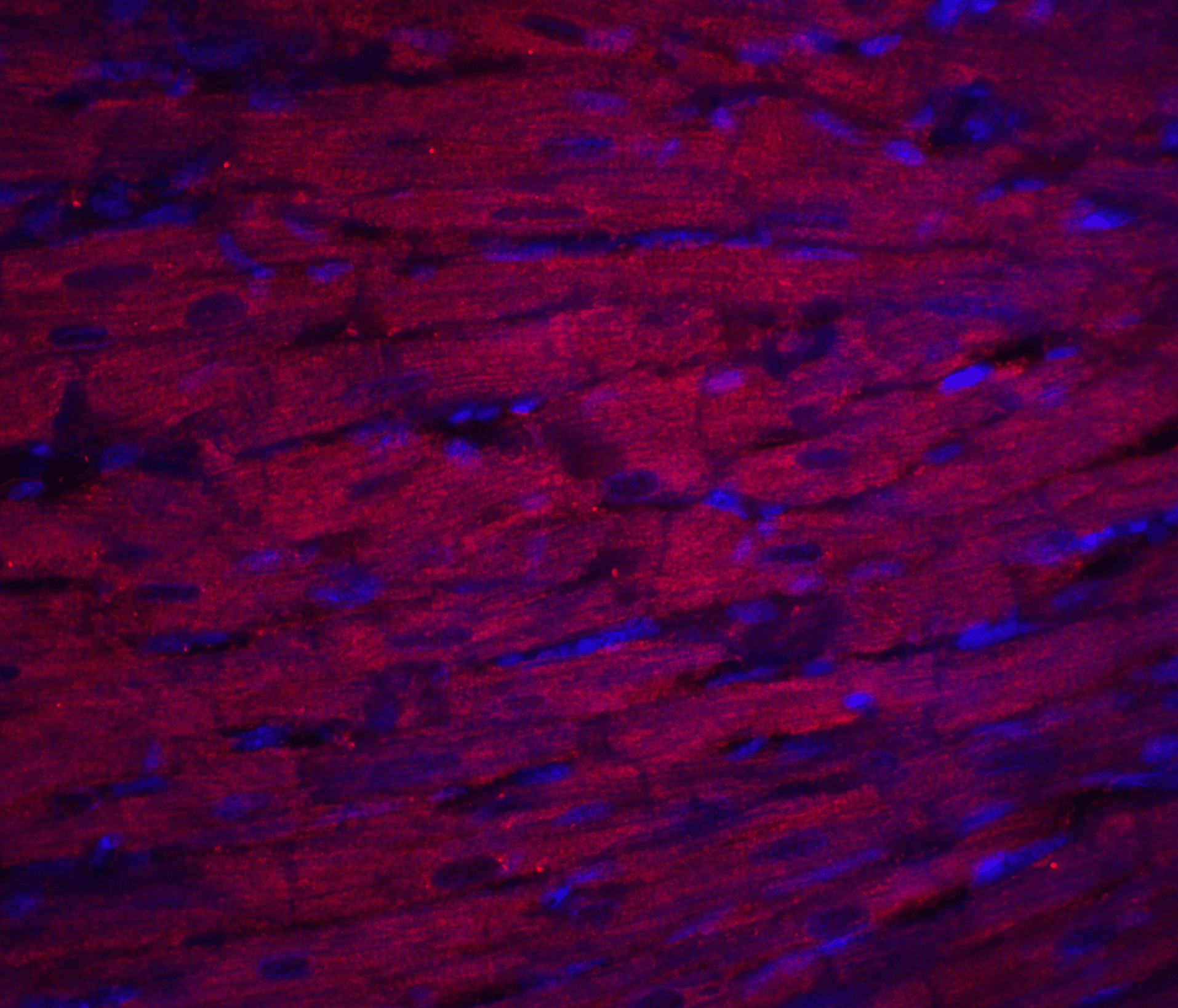 Immunofluorescence of ASAH1 in rat heart tissue with ASAH1 antibody at 20 μg/mL.<br><br>Red: ASAH1 Antibody (4741) <br> Blue: DAPI staining Immunofluorescence of ASAH1 in rat heart tissue with ASAH1 antibody at 20 μg/mL.<br><br>Red: ASAH1 Antibody (4741) <br> Blue: DAPI staining