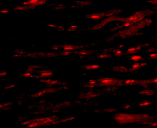 Immunofluorescence of ASAH1 in Human Heart cells with ASAH1 antibody at 20 μg/mL. Immunofluorescence of ASAH1 in Human Heart cells with ASAH1 antibody at 20 μg/mL.