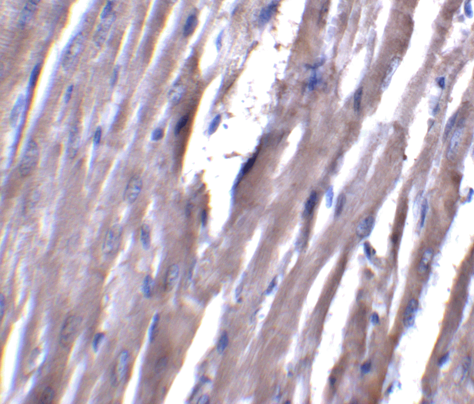 Immunohistochemistry of ASAH1 in rat heart tissue with ASAH1 antibody at 5 μg/mL. Immunohistochemistry of ASAH1 in rat heart tissue with ASAH1 antibody at 5 μg/mL.
