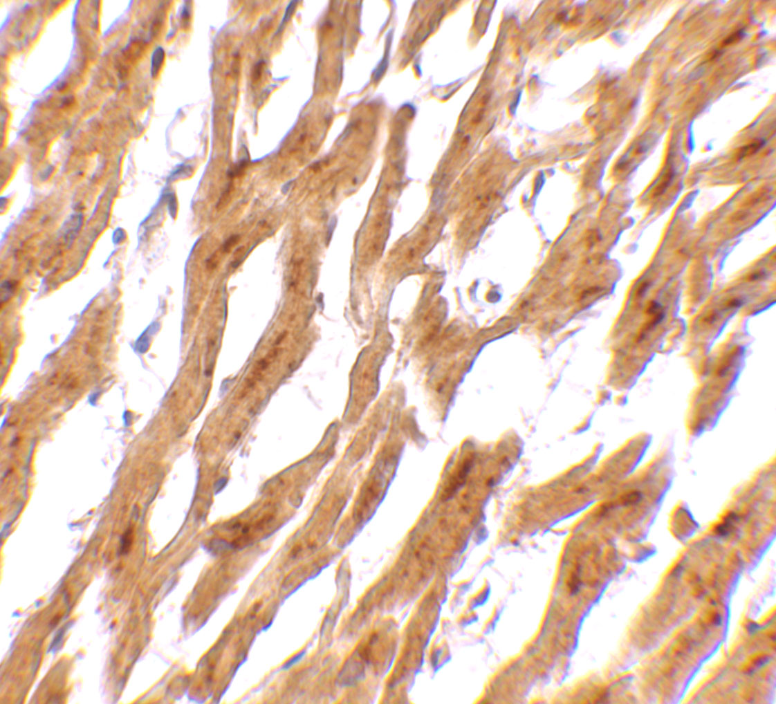 Immunohistochemistry of ASAH1 in human heart tissue with ASAH1 antibody at 2.5 μg/mL. Immunohistochemistry of ASAH1 in human heart tissue with ASAH1 antibody at 2.5 μg/mL.