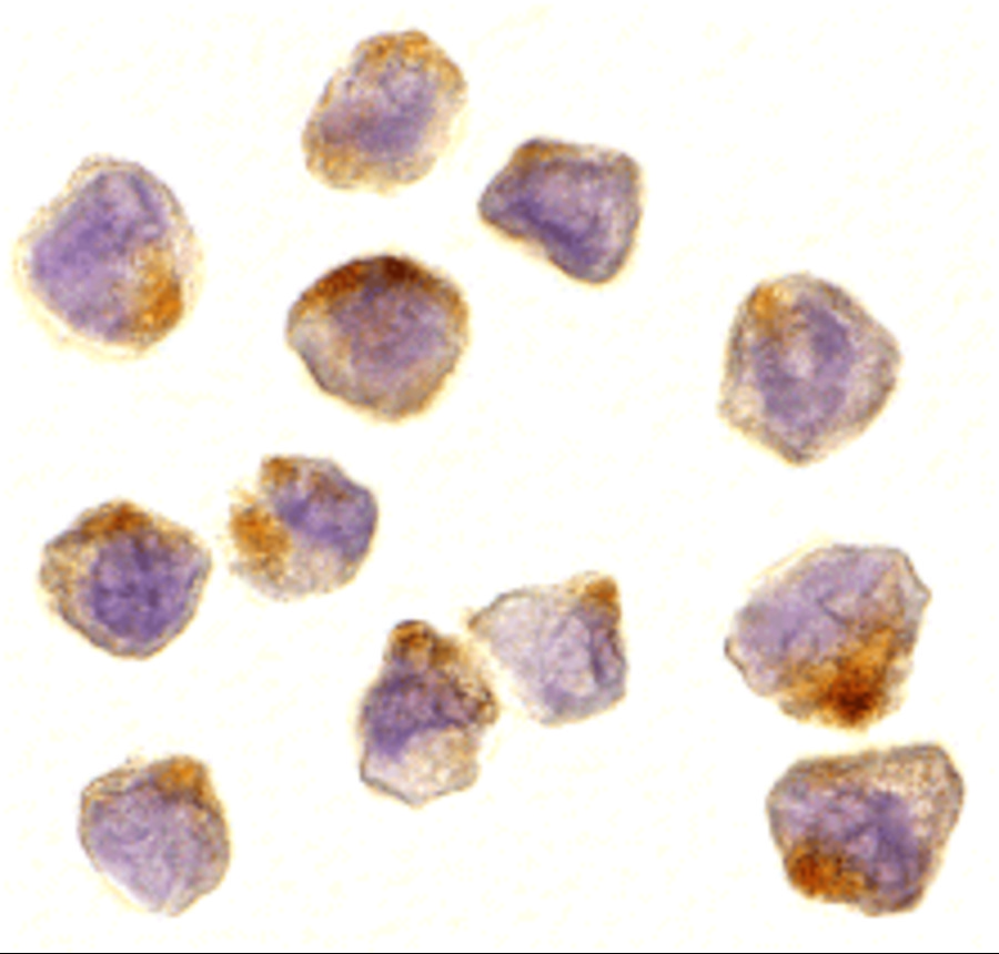 Immunocytochemistry of ASK1 in A431 cells with ASK1 antibody at 10 μg/mL. Immunocytochemistry of ASK1 in A431 cells with ASK1 antibody at 10 μg/mL.