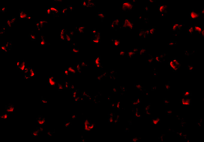 Immunofluorescence of ASK1 in A431 cells with ASK1 antibody at 20 μg/mL. Immunofluorescence of ASK1 in A431 cells with ASK1 antibody at 20 μg/mL.