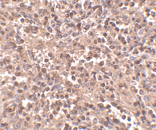 Immunohistochemistry of ATG5 in human spleen tissue with ATG5 antibody at 2.5 μg/mL.