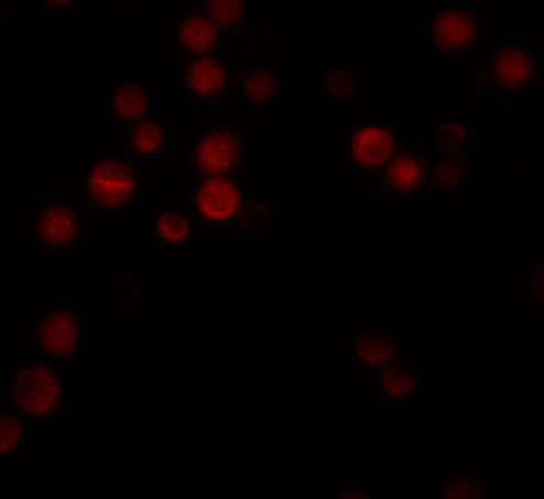 Immunofluorescence of ATG9B in Hela cells with ATG9B antibody at 20 μg/mL. Immunofluorescence of ATG9B in Hela cells with ATG9B antibody at 20 μg/mL.