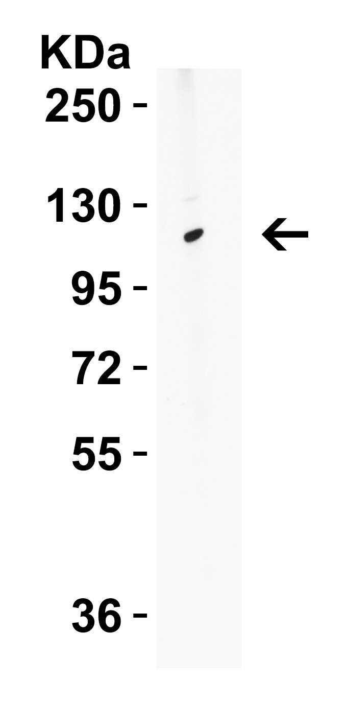 <strong>WB Validation in Human Tonsil</strong> Loading: 15 μg of human tonsil lysate.
Antibodies: ATG9B 5797, 2 μg/mL , 1 h incubation at RT in 5% NFDM/TBST.
Secondary: Goat Anti-Rabbit IgG HRP conjugate at 1:10000 dilution. <strong>WB Validation in Human Tonsil</strong> Loading: 15 μg of human tonsil lysate.
Antibodies: ATG9B 5797, 2 μg/mL , 1 h incubation at RT in 5% NFDM/TBST.
Secondary: Goat Anti-Rabbit IgG HRP conjugate at 1:10000 dilution.