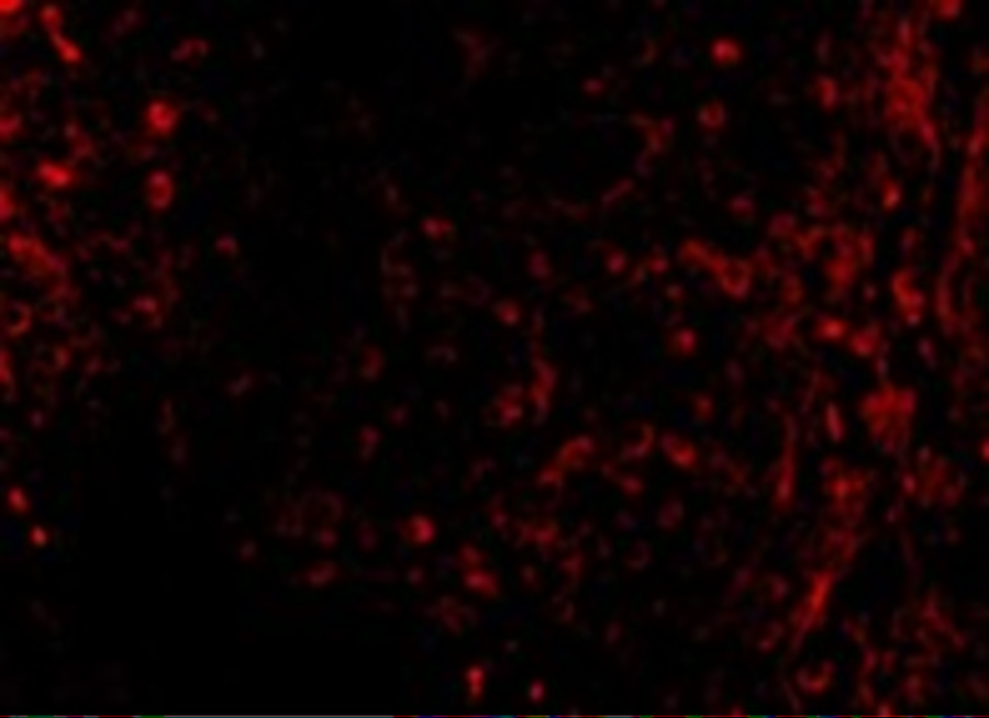 Immunofluorescence of ATM in Human Lymph Node cells with ATM antibody at 10 μg/mL.