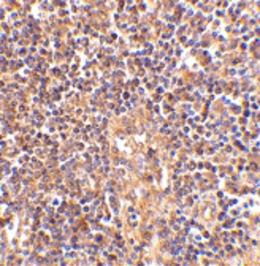 Immunohistochemistry of ATM in human lymph node tissue with ATM antibody at 2.5 μg/mL.