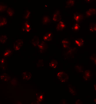 Immunofluorescence of ATP2C2 in 3T3 cells with ATP2C2 antibody at 20 μg/mL. Immunofluorescence of ATP2C2 in 3T3 cells with ATP2C2 antibody at 20 μg/mL.
