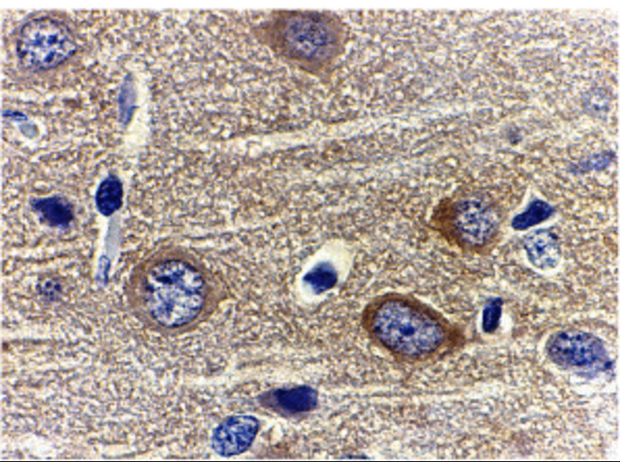 Immunohistochemistry of adiponectin in rat brain tissue with adiponectin antibody at 1 μg/mL. Immunohistochemistry of adiponectin in rat brain tissue with adiponectin antibody at 1 μg/mL.