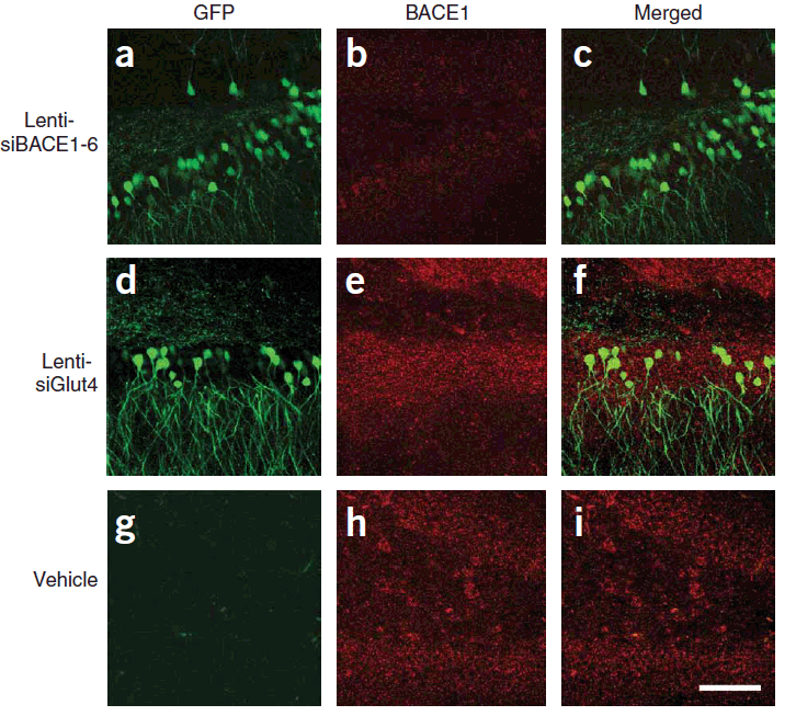 <strong>Figure 8 KD Validation of BACE in Mouse Brain (Singer et al., 2005)</strong><br>
Immunolabeling patterns of BACE1 expression and the lenti-siRNA distribution. Sections from APP transgenic mice treated with the eGFPtagged lenti siRNA vectors (green) were co-immunolabeled with an antibody against BACE1 (red) and imaged with the LSCM. All sections are from the hippocampus of treated mice. (a?c) Lenti-siBACE1-6?treated mice. Areas within the hippocampus expressing the eGFP tagged vector have reduced BACE1 immunolabeling. (d?f) Mice treated with the eGFP-tagged control lenti-siGlut4 show unchanged expression of BACE1 in the hippocampus. (g?i) Mice treated with a saline vehicle show unchanged expression of BACE1 in the hippocampus.. <strong>Figure 8 KD Validation of BACE in Mouse Brain (Singer et al., 2005)</strong><br>
Immunolabeling patterns of BACE1 expression and the lenti-siRNA distribution. Sections from APP transgenic mice treated with the eGFPtagged lenti siRNA vectors (green) were co-immunolabeled with an antibody against BACE1 (red) and imaged with the LSCM. All sections are from the hippocampus of treated mice. (a?c) Lenti-siBACE1-6?treated mice. Areas within the hippocampus expressing the eGFP tagged vector have reduced BACE1 immunolabeling. (d?f) Mice treated with the eGFP-tagged control lenti-siGlut4 show unchanged expression of BACE1 in the hippocampus. (g?i) Mice treated with a saline vehicle show unchanged expression of BACE1 in the hippocampus..