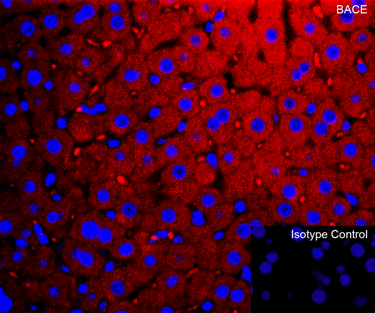 <strong>Figure 5 Immunofluorescence Validation of BACE in Mouse Liver</strong><br>
Immunofluorescent analysis of 4% paraformaldehyde-fixed mouse liver tissue labeling BACE with 2253 at 10 μg/mL, followed by goat anti-rabbit IgG secondary antibody at 1/500 dilution (red) and DAPI staining (blue). <strong>Figure 5 Immunofluorescence Validation of BACE in Mouse Liver</strong><br>
Immunofluorescent analysis of 4% paraformaldehyde-fixed mouse liver tissue labeling BACE with 2253 at 10 μg/mL, followed by goat anti-rabbit IgG secondary antibody at 1/500 dilution (red) and DAPI staining (blue).