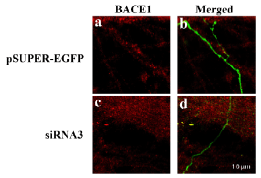 <strong>Figure 10 KD Validation of BACE in DRG (Hyun, 2007) </strong><br>
Decreased BACE1 expression in DRG following siRNA3 transfection. DRG neurons were transfected with 1 ?g siRNA3 plasmid and incubated for 48 hours in 37?˚C. DRG neurons were stained for BACE1 us?ing the Anti-BACE antibody (ProSci). (a,b) Neurons transfected with the control plas?mid pSUPER-EGFP (green) did not display any changes in BACE1 expression (red). (c,d) DRG neurons transfected with siR?NA3 displayed reduced BACE1 expression in the axon. <strong>Figure 10 KD Validation of BACE in DRG (Hyun, 2007) </strong><br>
Decreased BACE1 expression in DRG following siRNA3 transfection. DRG neurons were transfected with 1 ?g siRNA3 plasmid and incubated for 48 hours in 37?˚C. DRG neurons were stained for BACE1 us?ing the Anti-BACE antibody (ProSci). (a,b) Neurons transfected with the control plas?mid pSUPER-EGFP (green) did not display any changes in BACE1 expression (red). (c,d) DRG neurons transfected with siR?NA3 displayed reduced BACE1 expression in the axon.