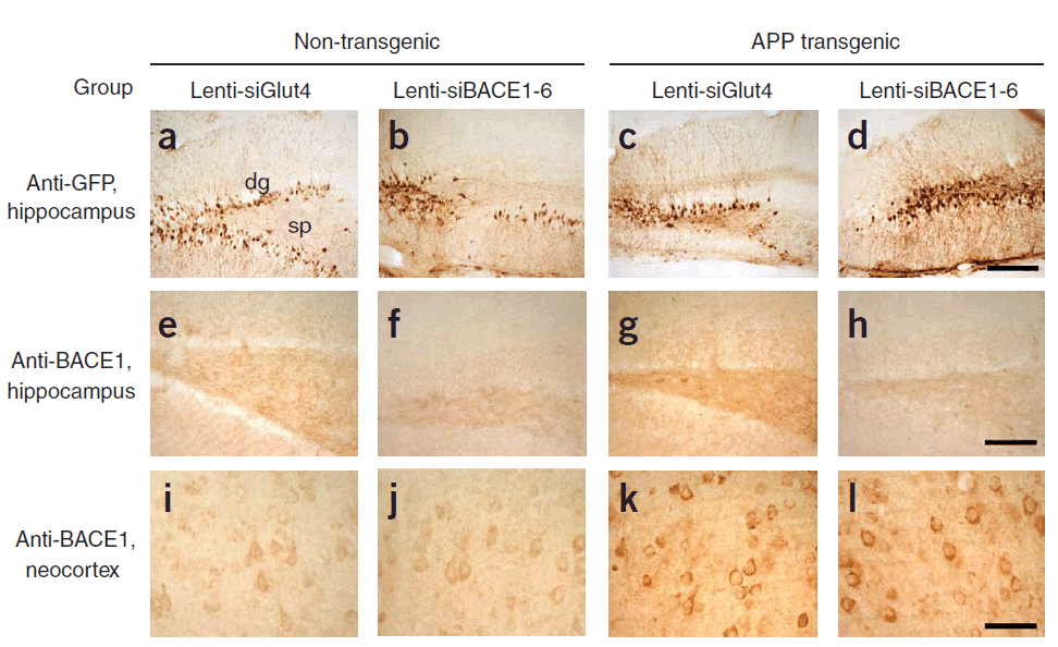 <strong>Figure 7 KD Validation of BACE in Mouse Brain (Singer et al., 2005)</strong><br>
Characterization of the effects of lenti-siBACE1-6 expression in the brains of APP transgenic mice. (a?d) Anti-eGFP immunoreactivity in the hippocampus (the injection site) shows comparable and consistent expression of lenti-siRNA constructs in the dentate gyrus (dg) and stratus polymorphus (sp). (e) Anti-BACE1 immunoreactivity in the hippocampus of nontransgenic mice treated with lenti-siGlut4. (f) Reduced BACE1 immunostaining in the hippocampus of nontransgenic mice treated with lenti-siBACE1-6 vector. (g) Intense BACE1 immunoreactivity in the hippocampus of APP transgenic mice treated with lenti-siGlut4. (h) Reduced BACE1 expression in APP transgenic mice treated with lenti-siBACE1-6 vector. (i,j) Anti-BACE1 reacted with pyramidal cell bodies in the neocortex, which was not injected, <strong>Figure 7 KD Validation of BACE in Mouse Brain (Singer et al., 2005)</strong><br>
Characterization of the effects of lenti-siBACE1-6 expression in the brains of APP transgenic mice. (a?d) Anti-eGFP immunoreactivity in the hippocampus (the injection site) shows comparable and consistent expression of lenti-siRNA constructs in the dentate gyrus (dg) and stratus polymorphus (sp). (e) Anti-BACE1 immunoreactivity in the hippocampus of nontransgenic mice treated with lenti-siGlut4. (f) Reduced BACE1 immunostaining in the hippocampus of nontransgenic mice treated with lenti-siBACE1-6 vector. (g) Intense BACE1 immunoreactivity in the hippocampus of APP transgenic mice treated with lenti-siGlut4. (h) Reduced BACE1 expression in APP transgenic mice treated with lenti-siBACE1-6 vector. (i,j) Anti-BACE1 reacted with pyramidal cell bodies in the neocortex, which was not injected,