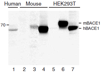 <strong>Figure 6 KO and Overexpression Validation of BACE in Human and Mouse Brain and 293 Cells. (Singer et al., 2005) </strong><br>
Western blot analysis of the BACE1 (2253) antibody's ability to recognize human and murine BACE1. The BACE1 antibody recognized both the mouse and human forms of BACE1. Lanes 1?4 are frontal cortex homogenates from human and mouse brains. Lane 1 is from a neurologically unimpaired aged human control case, lane 2 from a BACE1-deficient mouse, lane 3 from a nontransgenic mouse and lane 4 from hBACE1 transgenic mouse. Lanes 5?7 are lysates from HEK293T cells transfected with a plasmid vector expressing eGFP, mBACE1 and hBACE1, respectively. <strong>Figure 6 KO and Overexpression Validation of BACE in Human and Mouse Brain and 293 Cells. (Singer et al., 2005) </strong><br>
Western blot analysis of the BACE1 (2253) antibody's ability to recognize human and murine BACE1. The BACE1 antibody recognized both the mouse and human forms of BACE1. Lanes 1?4 are frontal cortex homogenates from human and mouse brains. Lane 1 is from a neurologically unimpaired aged human control case, lane 2 from a BACE1-deficient mouse, lane 3 from a nontransgenic mouse and lane 4 from hBACE1 transgenic mouse. Lanes 5?7 are lysates from HEK293T cells transfected with a plasmid vector expressing eGFP, mBACE1 and hBACE1, respectively.
