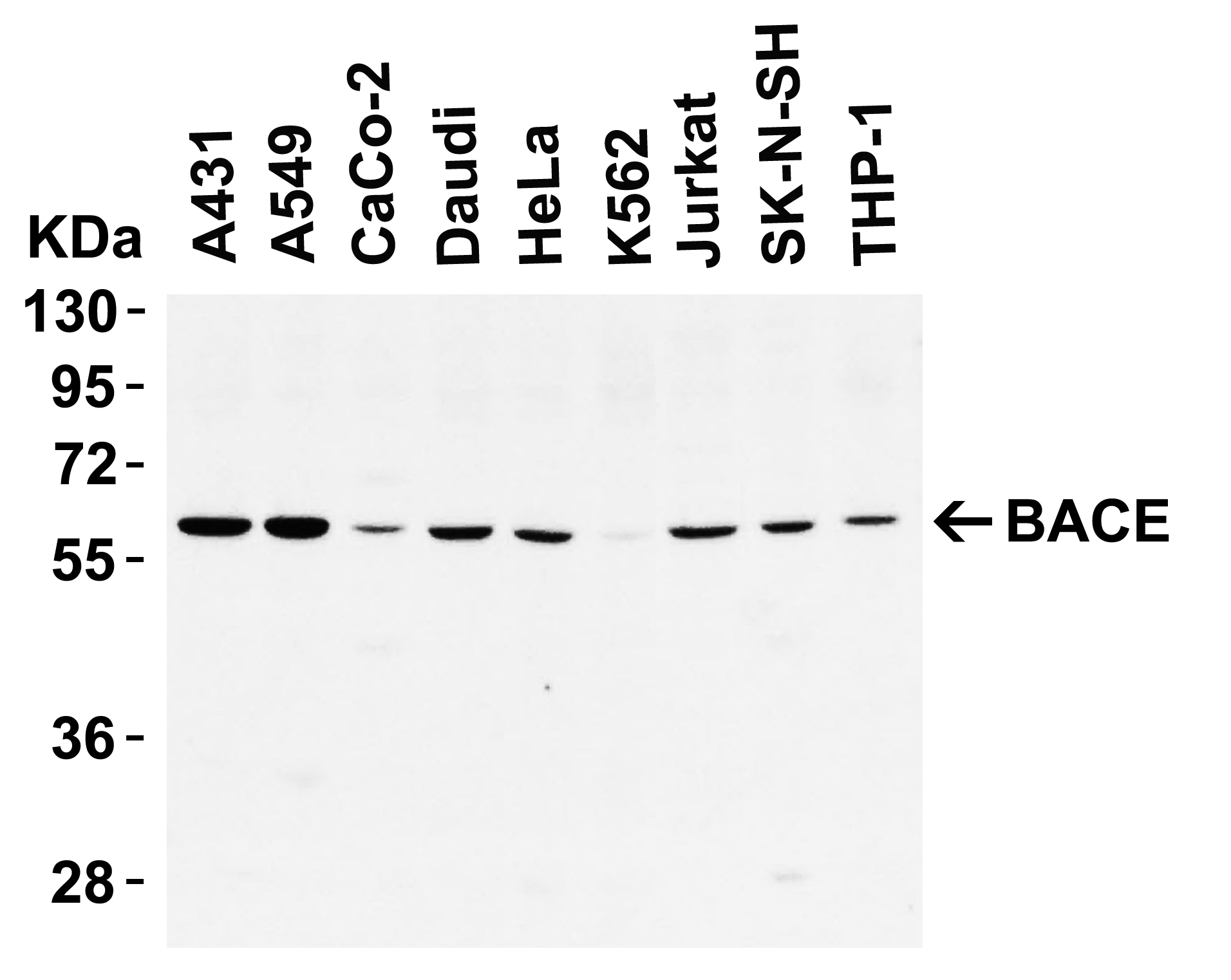 <strong> Figure 1 WB Validation in Human Cell Lines </strong><br>
Loading: 10 μg of lysate
Antibodies: BACE, 2253, 1 μ g/mL , 1 h incubation at RT in 5% NFDM/TBST.
Secondary: Goat Anti-Rabbit IgG HRP conjugate at 1:10000 dilution. <strong> Figure 1 WB Validation in Human Cell Lines </strong><br>
Loading: 10 μg of lysate
Antibodies: BACE, 2253, 1 μ g/mL , 1 h incubation at RT in 5% NFDM/TBST.
Secondary: Goat Anti-Rabbit IgG HRP conjugate at 1:10000 dilution.