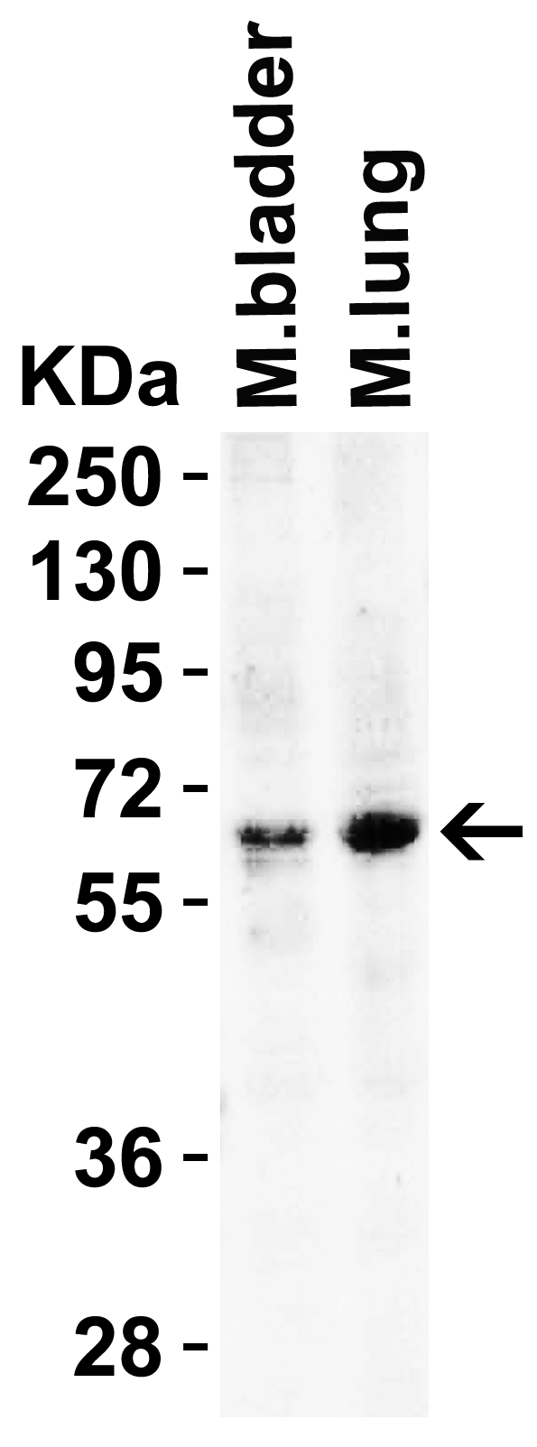 <strong>Figure 3 WB Validation in Mouse Tissues </strong><br>
Loading: 15 μg of lysate
Antibodies: BACE, 2253, 2 μg/mL , 1 h incubation at RT in 5% NFDM/TBST.
Secondary: Goat Anti-Rabbit IgG HRP conjugate at 1:10000 dilution. <strong>Figure 3 WB Validation in Mouse Tissues </strong><br>
Loading: 15 μg of lysate
Antibodies: BACE, 2253, 2 μg/mL , 1 h incubation at RT in 5% NFDM/TBST.
Secondary: Goat Anti-Rabbit IgG HRP conjugate at 1:10000 dilution.