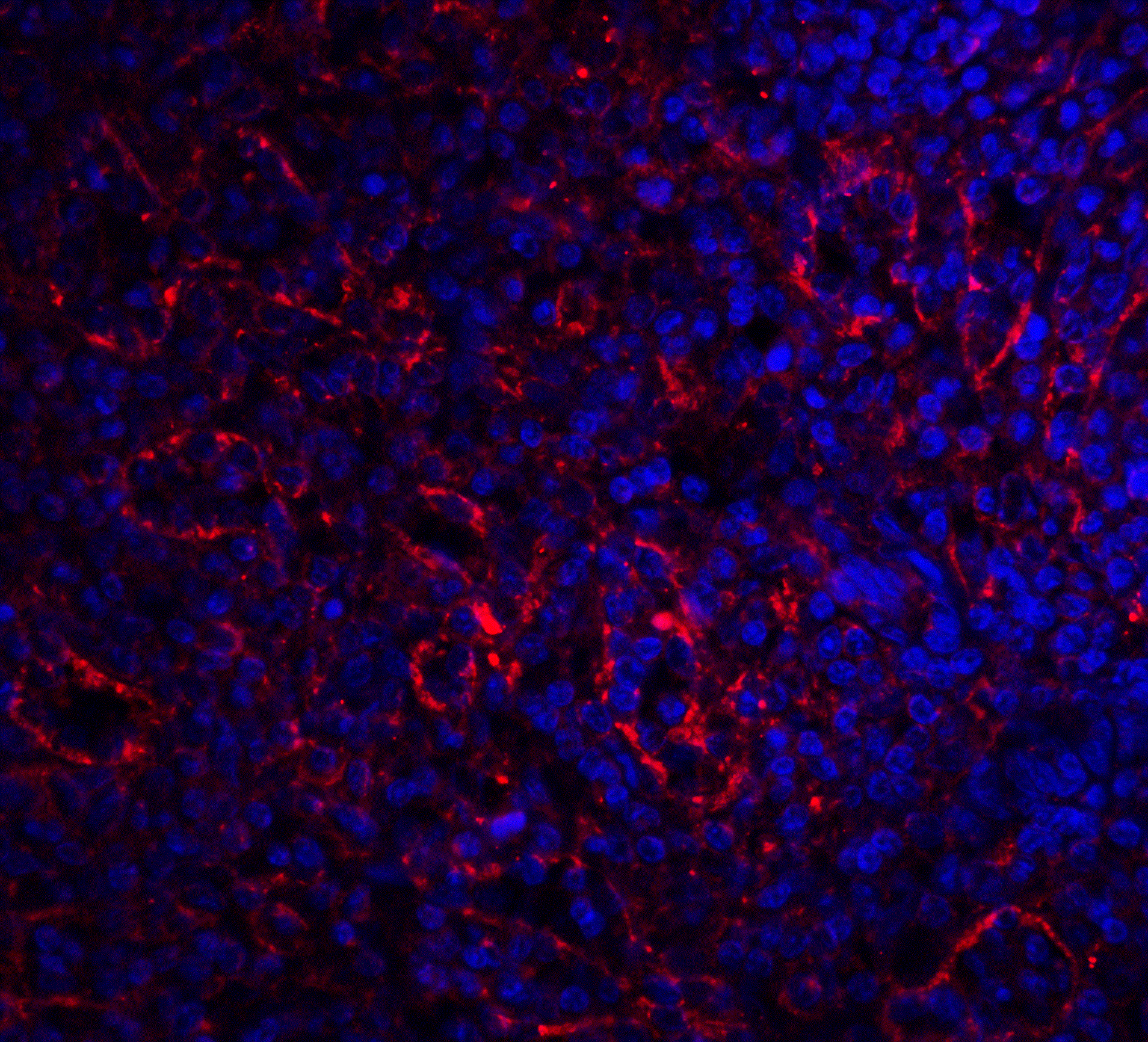 Immunofluorescence of BAFF-R in human spleen tissue with BAFF-R antibody at 20 μg/ml.<br><br>Red: BAFF Receptor Antibody (3097) <br> Blue: DAPI staining Immunofluorescence of BAFF-R in human spleen tissue with BAFF-R antibody at 20 μg/ml.<br><br>Red: BAFF Receptor Antibody (3097) <br> Blue: DAPI staining