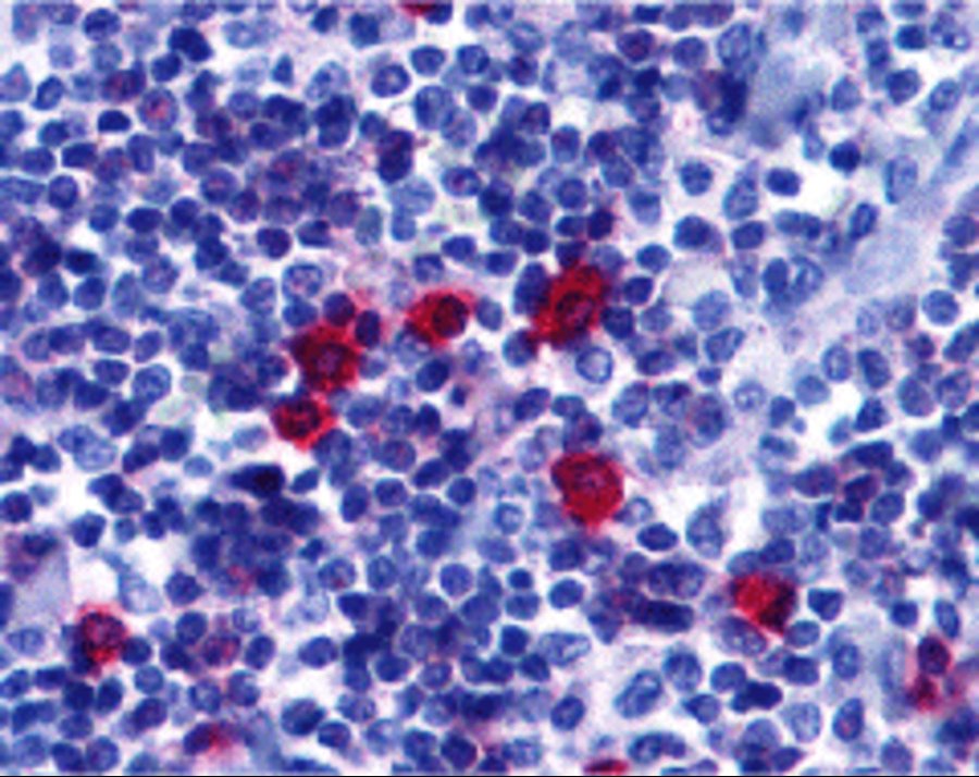 Immunohistochemistry of BAFF Receptor in human tonsil tissue with BAFF Receptor antibody at 5 μg/mL. Immunohistochemistry of BAFF Receptor in human tonsil tissue with BAFF Receptor antibody at 5 μg/mL.