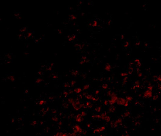 Immunofluorescence of BAG-1 in Human Lymph Node cells with BAG-1 antibody at 20 μg/mL. Immunofluorescence of BAG-1 in Human Lymph Node cells with BAG-1 antibody at 20 μg/mL.