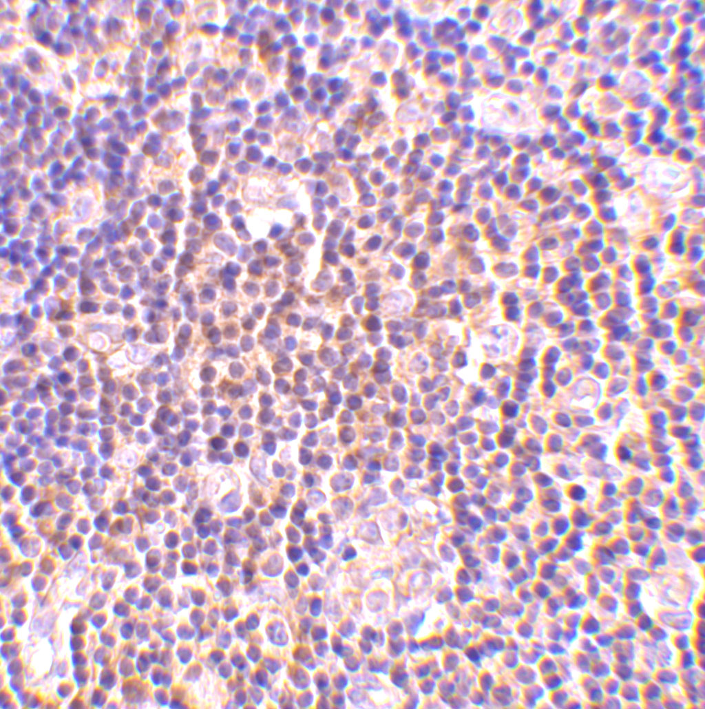 Immunohistochemistry of BAG-1 in human lymph node tissue with BAG-1 antibody at 2 μg/mL Immunohistochemistry of BAG-1 in human lymph node tissue with BAG-1 antibody at 2 μg/mL
