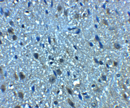 Immunohistochemistry of BCLAF1 in mouse brain tissue with BCLAF1 antibody at 5 μg/mL. Immunohistochemistry of BCLAF1 in mouse brain tissue with BCLAF1 antibody at 5 μg/mL.
