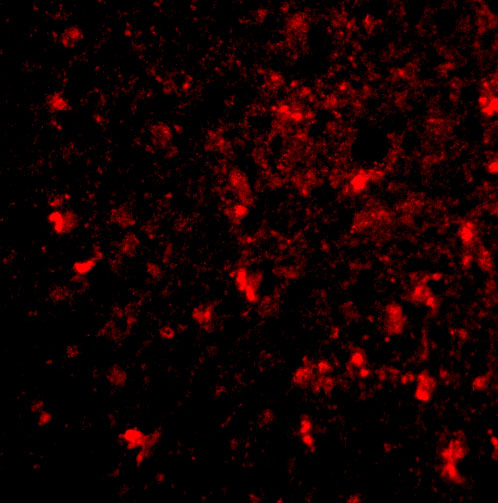 Immunofluorescence of BRCC45 in human brain tissue with BRCC45 antibody at 20 μg/mL. Immunofluorescence of BRCC45 in human brain tissue with BRCC45 antibody at 20 μg/mL.